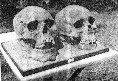 hybrid Neanderthal skulls